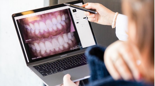 Dental Care