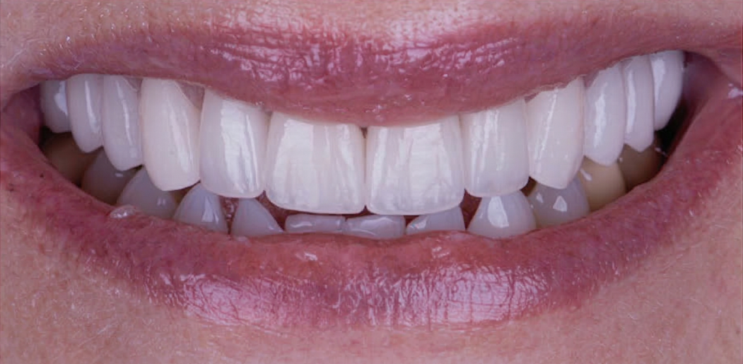 after1